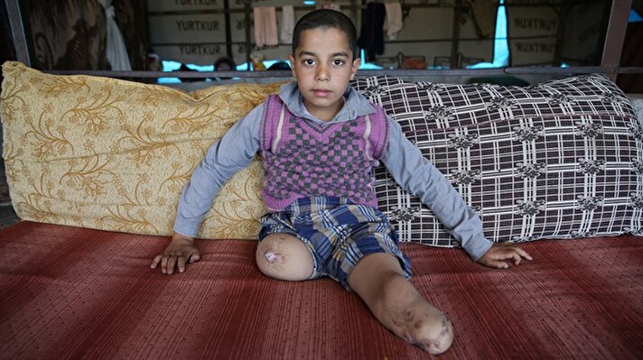  Suriye'nin Hama kentinde rejim güçlerinin saldırısında evleri isabet alan ve bu sırada iki bacağını yitiren 7 yaşındaki Abdulhalim Jonaidi, protez bacakla yeniden yürümek istiyor.