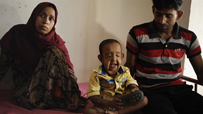 4 yaşındaki Bangladeşli Bayezid Hossain 'progeria' olarak da bilinen erken yaşlanma hastalığı sebebiyle Dakka Medikal Hastanesi'nde tedavi altına alındı.