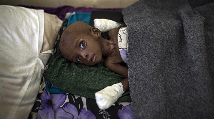 Somali'nin orta ve güney kesimlerinde yaşanan aşırı kuraklık nedeniyle çok sayıda insan açlık ve salgın hastalık tehdidiyle karşı karşıya kaldı. 