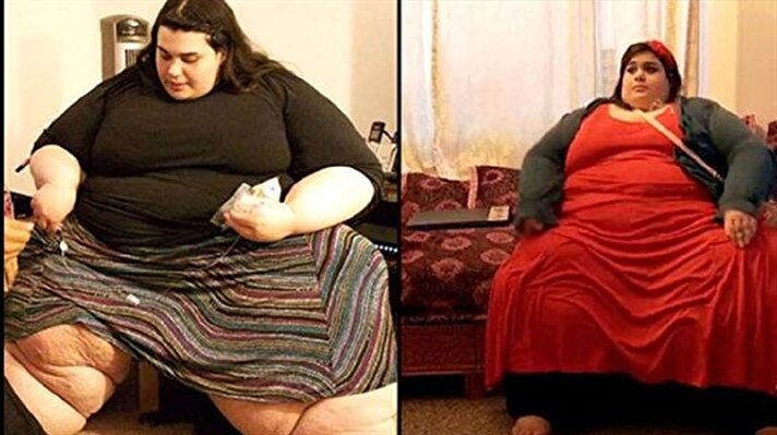 Amerika Oregon’da yaşayan Amber Rachdi, obezite hastalığına yakalandı ve genç yaşında 292 kilo ağırlığa ulaştı.

