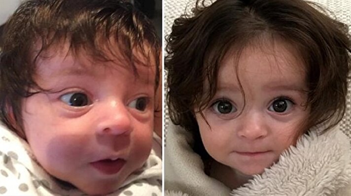 Avustralya'nın Sydney şehrinde yaşayan 6 aylık bebek Alexis Bartlett, dünyaya uzun saçları ile geldi. Yaşıtlarına göre uzun ve gür saçları ile çekiyor. 
