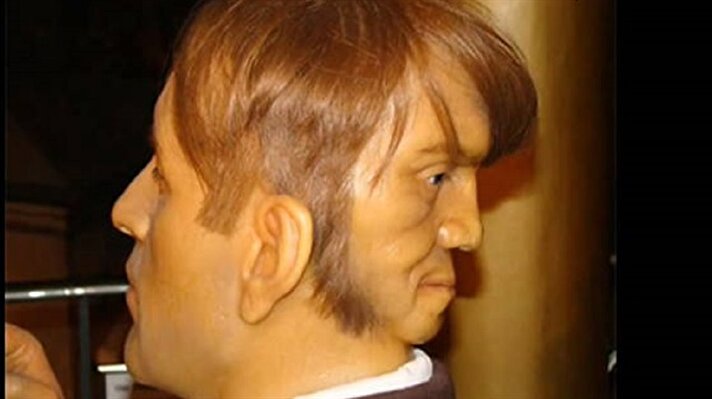 19. yüzyılda yaşamış olan Edward Mordake'in kafasının arkasında bir yüzü daha vardı. 