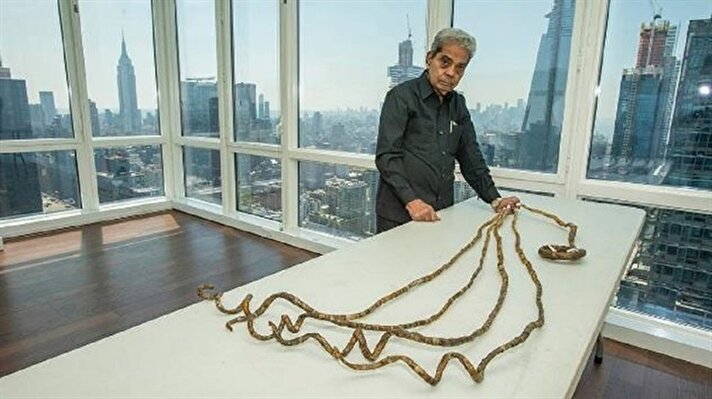طولها أكثر من 6 أمتار.. صاحب الأظافر الأطول في العالم يقرر قصها بعد 68 عاماً