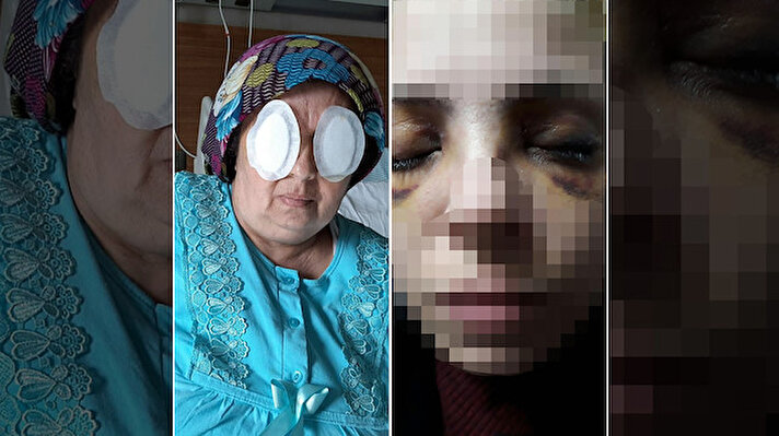 Adana Dr. Ekrem Tok Ruh Sağlığı Hastanesi'nde yatarak tedavi gören şizofreni hastası N.K., 1 Mart'ta aynı odada kaldığı 3 çocuk annesi Sultan Güner'in iki gözünü parmağıyla oydu. Sultan Güner, götürüldüğü Adana Şehir Hastanesi'nde tedaviye alınırken, olayla ilgili başlatılan soruşturma kapsamında Dr. Ekrem Tok Ruh Sağlığı Hastanesi Başhekimi ile 1 başhekim yardımcısının da aralarında bulunduğu 8 personel açığa alındı. N.K. de tek kişilik sünger odada gözlem altına alındı. Soruşturmada N.K.'nın, kendisine küfrettiğini ileri sürdüğü babaannesi K.K.'yi baltayla öldürdüğü de ortaya çıktı. 