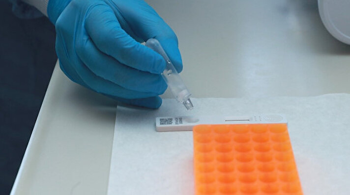 Sağlık Bakanlığı, virüsün yayılımını önlemek amacıyla Bilim Kurulunun önerisiyle test sayısını artırdı. 