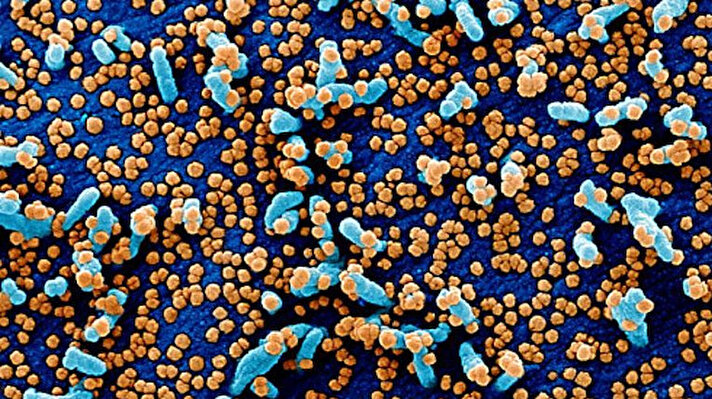  ABD'deki Ulusal Alerji ve Bulaşıcı Hastalıklar Enstitüsü (NIAID) koronavirüsün (Covid-19) insan hücrelerindeki yayılışını mikroskopla görüntüledi.​