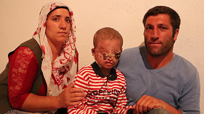 Yasemin-İdris İğneci çiftinin, 3 çocuğundan en küçüğü olan Salih'in 2 yaşındayken sol gözünün üzerinde bir kitle çıktı. Ameliyatla alınan kitle, çeşitli tarihlerde yüzünün birçok bölgesinde yeniden çıktı. Cilt kanseri teşhisi konan Salih'in tüm yüzünde yaralar oluştu. 10 kez ameliyat olan Salih'in sağ gözü yaralar nedeniyle kapandı, sol gözünde ise kısmı görme bozukluğu başladı.