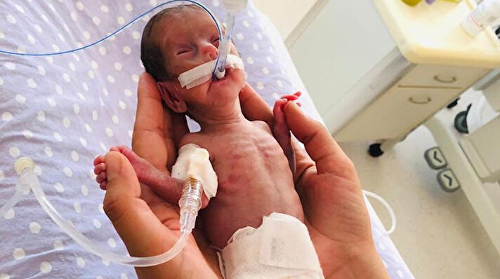 Anne Emete Varış, üçüncü çocuğuna hamile kaldıktan sonra gebeliğinin 23. haftasında ağrılarının artması üzerine doktora başvurdu. Selçuk Üniversitesi Tıp Fakültesi Hastanesinde sezaryenle 520 gram ağırlığında kız bebek dünyaya getiren anne, bebeğini 5 ay kuvözde süren tedavisinin ardından kucağına almanın mutluluğunu yaşadı.