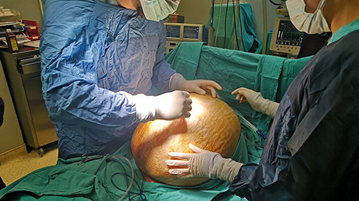 Tunceli'de yaşadığı sırada şişkinlik şikayeti ile doktora başvuran 25 yaşındaki Kader İşçi, hızla kilo almaya devam edince önce ikinci çocuğuna hamile olduğunu sandı. Ancak gebelik testi negatif çıktı.