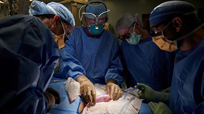New York Üniversitesi Langone Hastanesi'ndeki cerrahlar bir hayvandan alınan organı insan vücuduna başarıyla naklederek dünyada bir ilki başardı. Yeni gelişme, hayat kurtaran nakiller için hayvan organlarını kullanma konusunda onlarca yıl süren arayışta 'önemli bir adım'a işaret ediyor.<br><br>