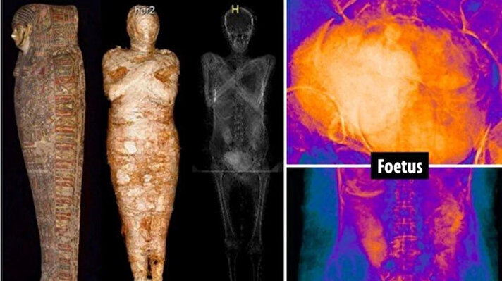 Mısırlı bir mumyanın karnında bulunan bir fetüsün, kadının vücudunun çürürken asitlenmesi nedeniyle 2 bin yıldan uzun bir süre boyunca korunduğu belirtildi.   <br><br>