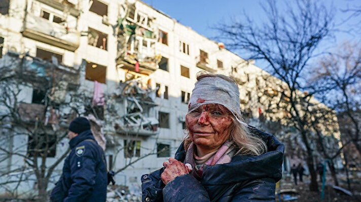 Rusya- Ukrayna savaşının mağdurlarından Olena Kurilo'nun sargılı gözünün görüntüleri tüm dünyada yayıldı.