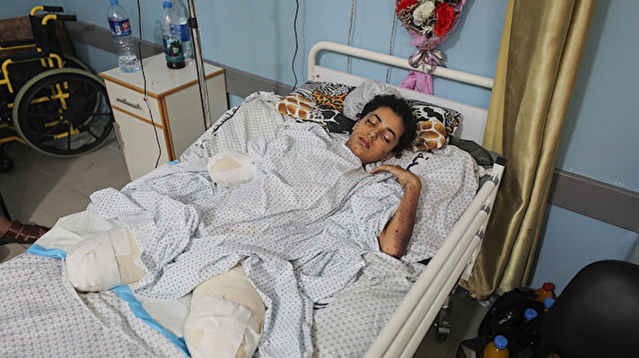 الطفلة 'رهف' بغزة تتطلع لمداواة جراحها في تركيا