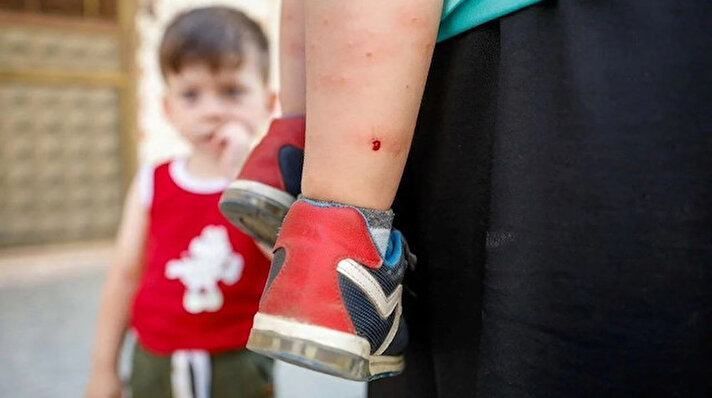 İstanbul'da 'Aedes' türü sivrisineklerde artış yaşanırken birçok mahallede bu durumdan rahatsız. O mahallelerden biri olan Bağcılar'da belediye 'sivrisinek mücadelesi'ni sürdürüyor.