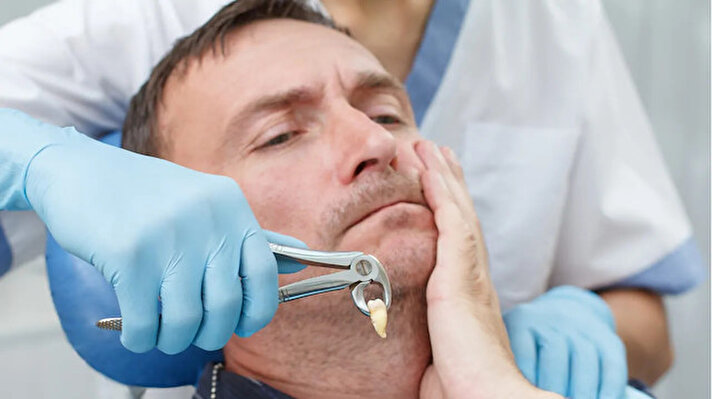 Diş Hekimi Dr. Melih Şengül, günlük hayatta bazı alışkanlıkların diş sağlığını tehdit ettiğini söyledi. Peki diş sağlığını etkileyen bu alışkanlıklar ne? Diş sağlığını nasıl koruyabiliriz?