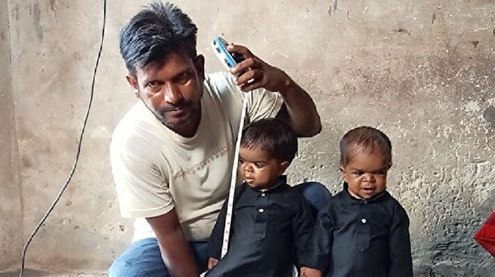 Hindistan’da yaşayan üç erkek kardeşin gizemli hastalığı dünya manşetlerine taşındı. 13 yaşındaki Daljeet, 11 yaşındaki Kamaljit ve 7 yaşındaki Ramneet Singh’in boyları yaklaşık 20 santimetre. Doktorlar ise kardeşlerin daha fazla uzayamayacağını söylüyor. 