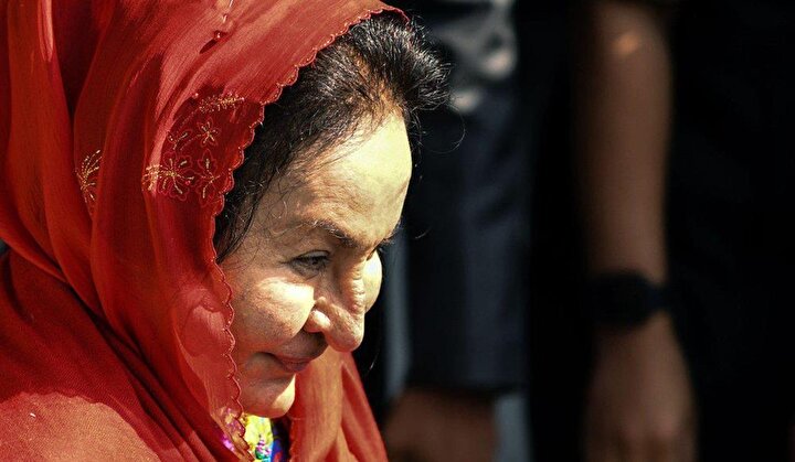 Necib Razak'ın eşi Rosmah Mansor, geçirdiği sayısız estetik ameliyatın ardından, tanınmaz hale geldi.