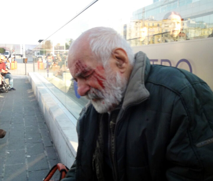 Ünlü oyuncunun kaza sonrasında yüzünde ciddi çizikler oluştu.