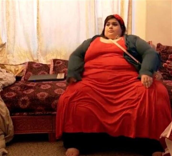 ‘Super obese’ Amber loses an astonishing 200kg | America