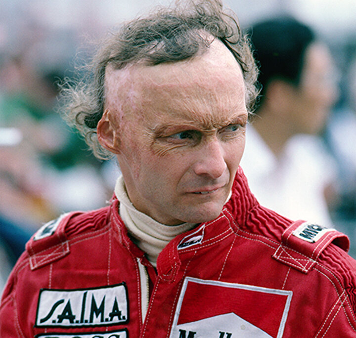 Lauda ve Hunt bu kadar zıt karakterler ve büyük rakipler olmalarına rağmen aralarında aslında güçlü de bir dostluk vardı. Öyle ki; Niki Lauda, yüzünün yandığı yarışın ardından ilk kez kameraların karşısına geçer. Dış görünüşüyle kazadan önce de barışık olmayan ve yakışıklı rakibi James Hunt ile kıyaslanan Lauda için ciddi bir karardır bu.