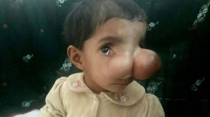 lanetli bebek fotograflari