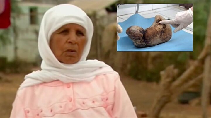 karnindaki bebegi 50 yil dogurmadi yeni safak