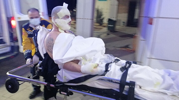 Otel odasında hem kendini hem de oteli yaktı