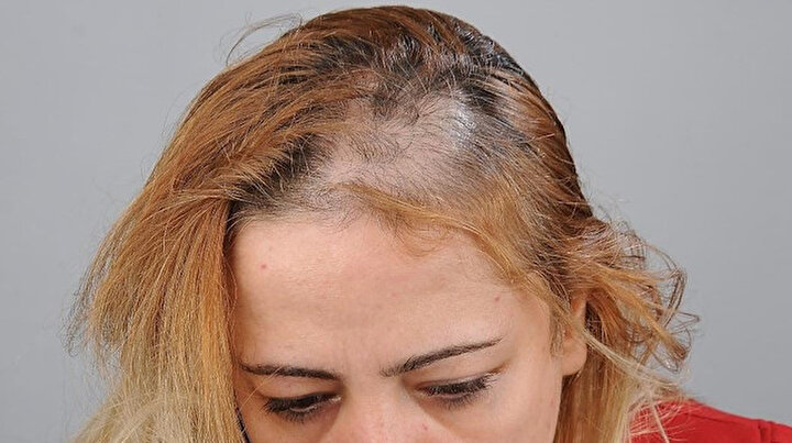 Sağlıkçılara şiddet durmuyor: Hemşireye muayene yerini neden parmağınla gösterdin dayağı