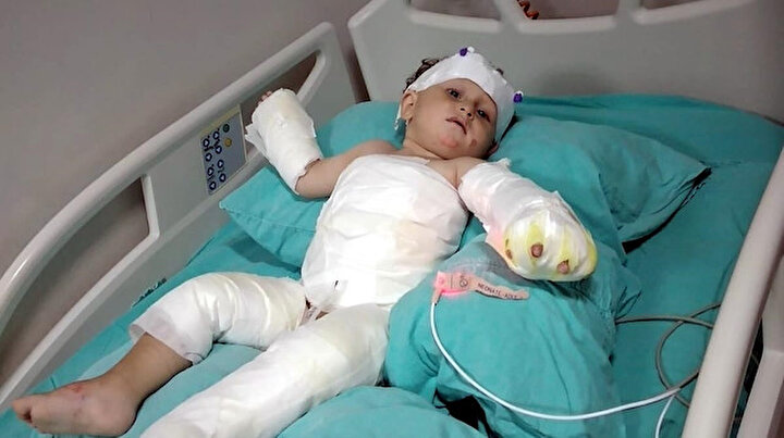 Birçok suçtan sabıkası olan adam ailesine dehşeti yaşattı: Eşi ve 1,5 yaşındaki oğlunu üzerine kolonya dökerek yaktı