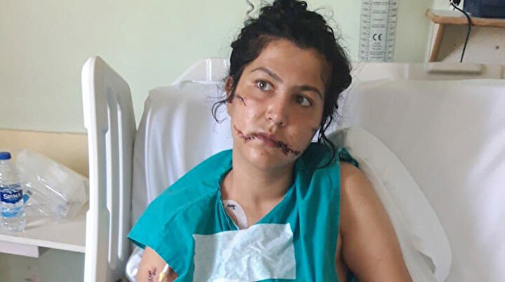 Böyle vahşet görülmedi: Daha önce de bıçaklandım ama ilk kez doğrandım