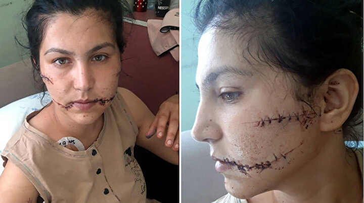 Eşinin 104 yerinden bıçakladığı Aysel: Tehdit ediyorlar, pencereye bile çıkamıyorum