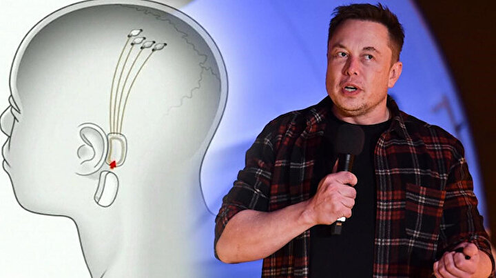 Elon Muskın çılgın projesi gerçek oluyor: İnsan beynine çip takacak