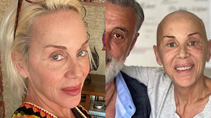 Billur Kalkavandan sağlık durumuyla ilgili yeni paylaşım: Tek bir ricam var