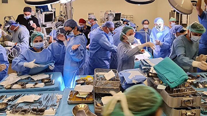 İstanbulda dokuz saatlik operasyon: Siyam ikizleri ameliyatla ayrıldı