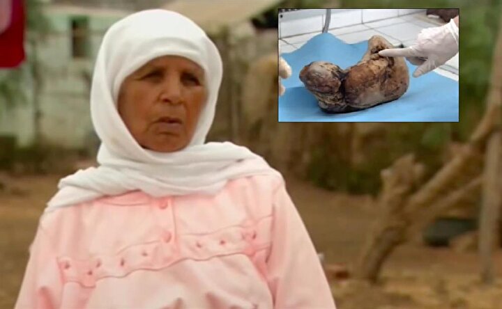 karnindaki bebegi 50 yil dogurmadi yeni safak