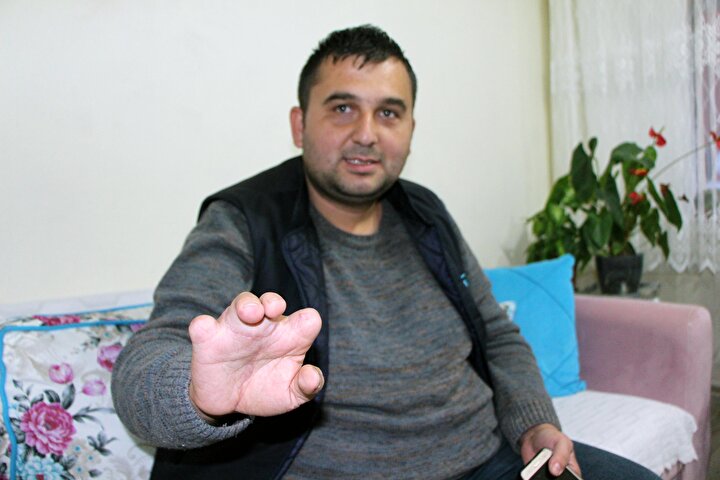 Ayak Parmaklari Eline Nakledildi Dunyaya Yeniden Gelmis Gibiyim
