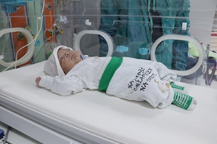 Parmak Bebek Hayata Tutundu Yarim Kilo Dogmustu Simdi Turp Gibi