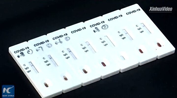 Çinin Hubey eyaletine bağlı Vuhan kentinde ortaya çıkan yeni tip koronavirüs (Kovid-19) sebebiyle tüm dünyanın korkutucu bekleyişi sürüyor.