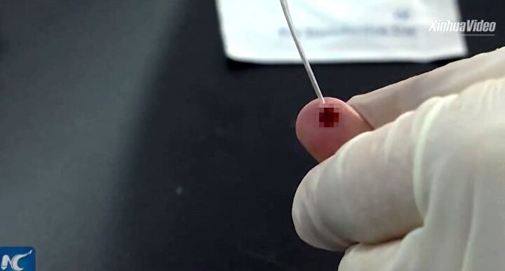 İlk aşamada parmak ucundan alınan kan, test kitine aktarılıyor. 