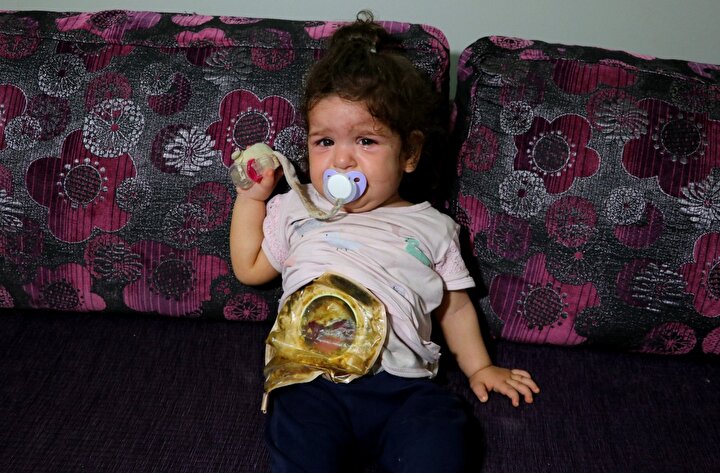 Minik Mariya bağırsağına takılan torbayla hayata tutunuyor 3 50d1296359bb423682fd376fe30765c5