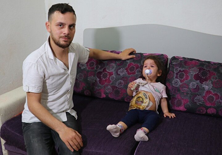 Minik Mariya bağırsağına takılan torbayla hayata tutunuyor 8 7b389c4c0ad14636bad98778ea425be7