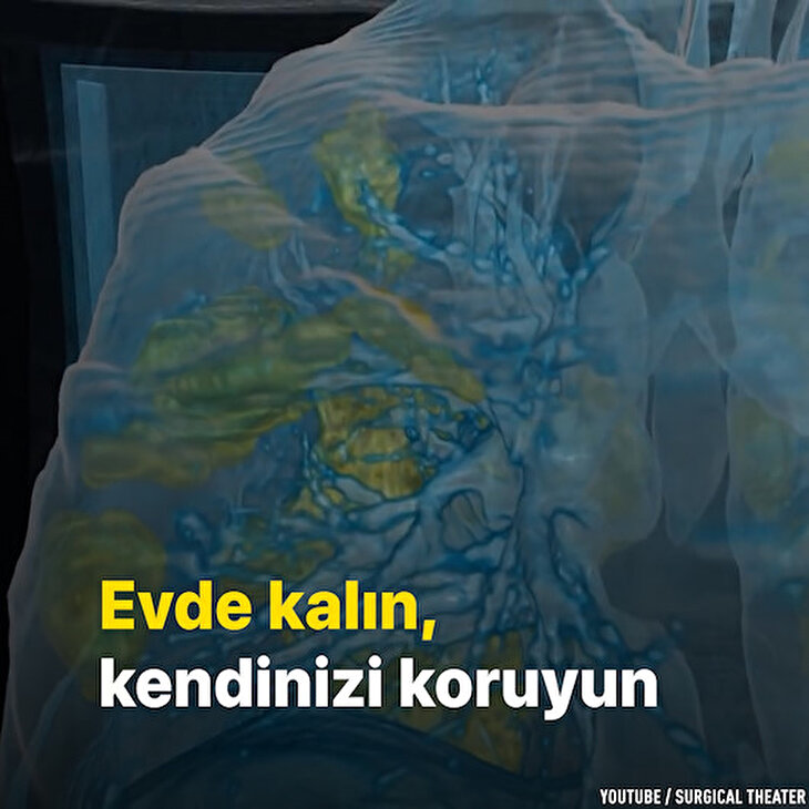 Koronavirüsün ciğerlere verdiği zarar sanal gerçeklik videosuyla görüldü