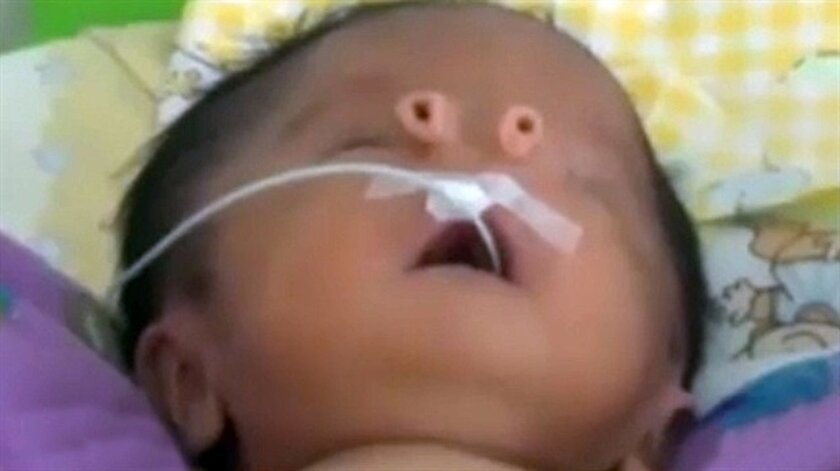 Dünyanın en farklı bebek burnu