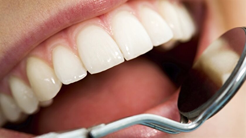 Diş eti neden kanar? Diş Eti hastalıkları Yeni Şafak