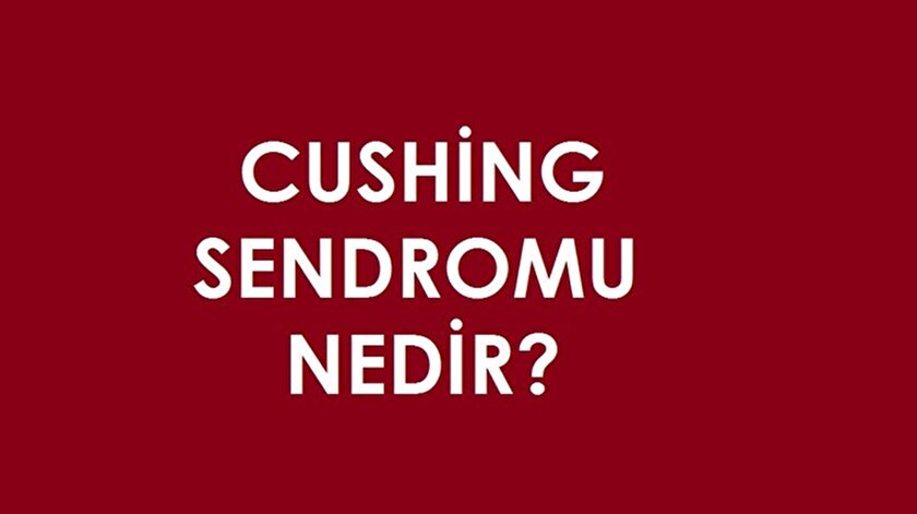 Cushing sendromu nedir ve belirtileri nelerdir?