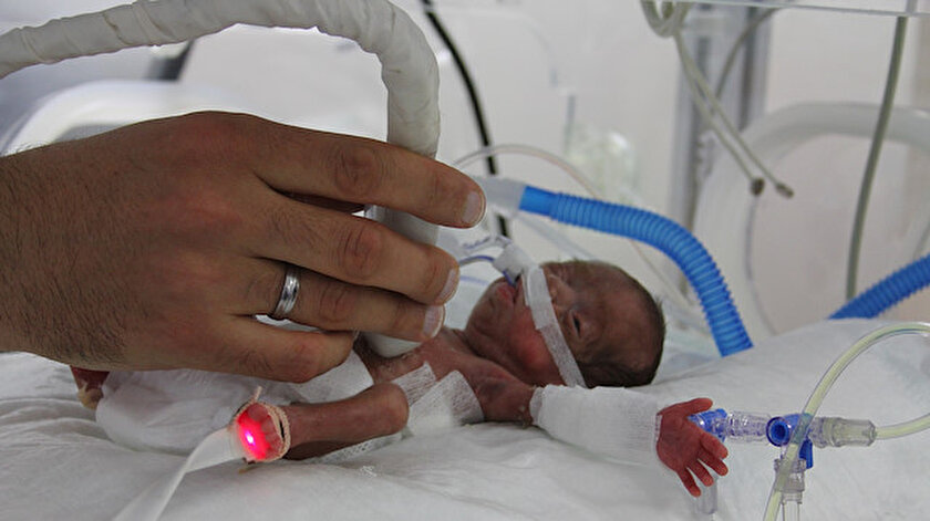 Sadece 514 Gram Bebek Premature Bebek Nedir