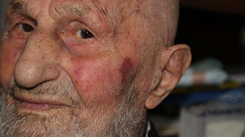 95 yaşındaki amcayı dövdüler