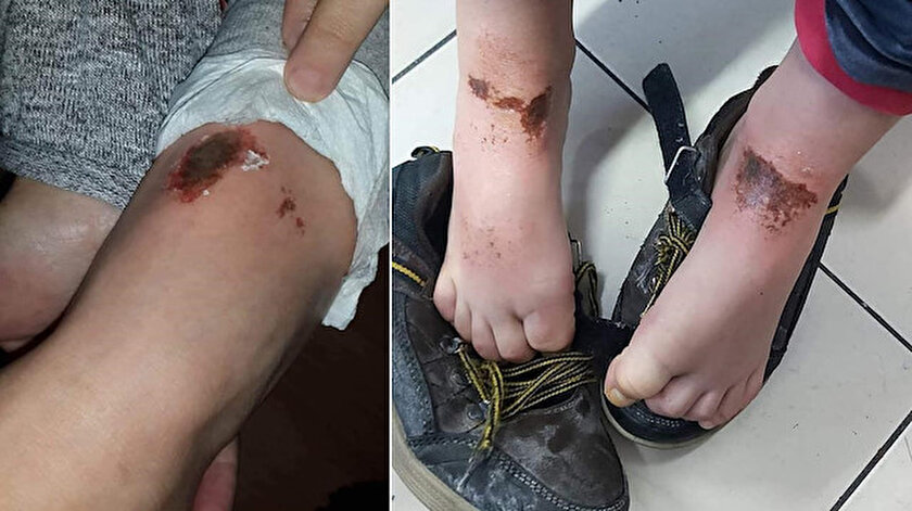 Aileleri tarafından hastanelere götürülen öğrencilerden 7'si tedavilerinin ardından taburcu edildi.