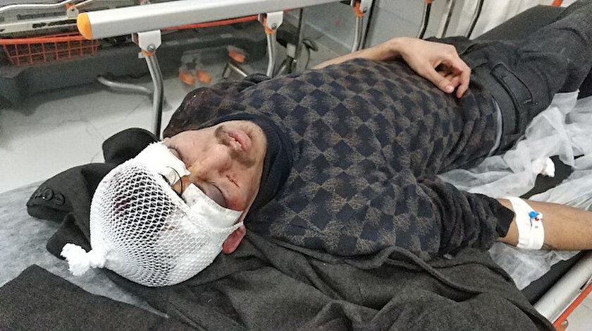 Sopalı dehşet: Evine zorla girip hastanelik ettiler