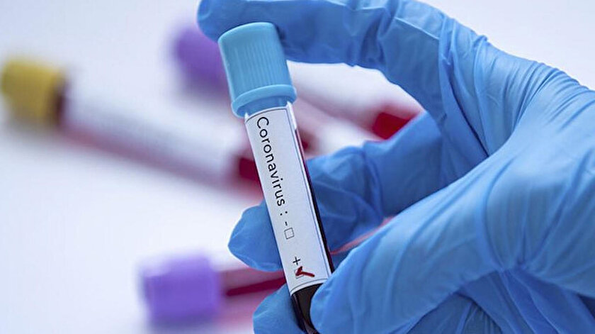 Ülkeler salgınla mücadele ediyor: İranda koronavirüs teşhis kiti üretilmeye başlandı